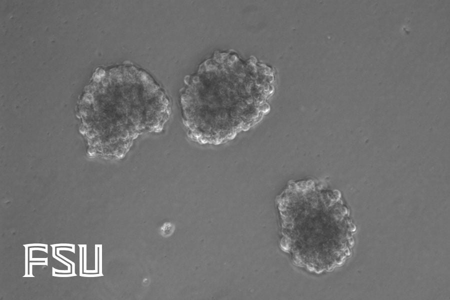 Microscopic view of human mesenchymal stem cell spheroids set against a neutral gray background. Three translucent, rounded cell clusters with bumpy surfaces are visible, two positioned near the top center and one toward the bottom right. The Florida State University monogram logo ("FSU") appears outlined in white in the bottom left corner.